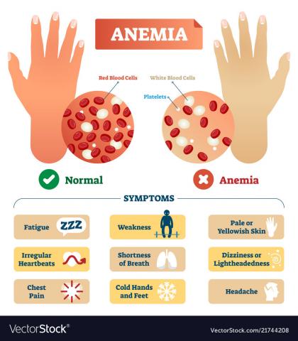 Anemia research paper