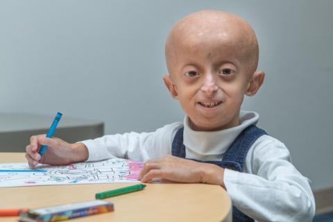 PROGERIA