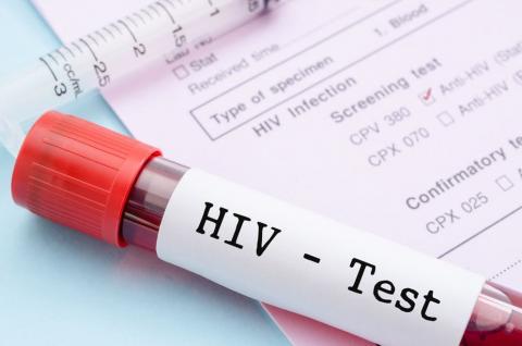 HIV AMONG 50 YR OLD FREE ESSAY SAMPLES & OUTLINE